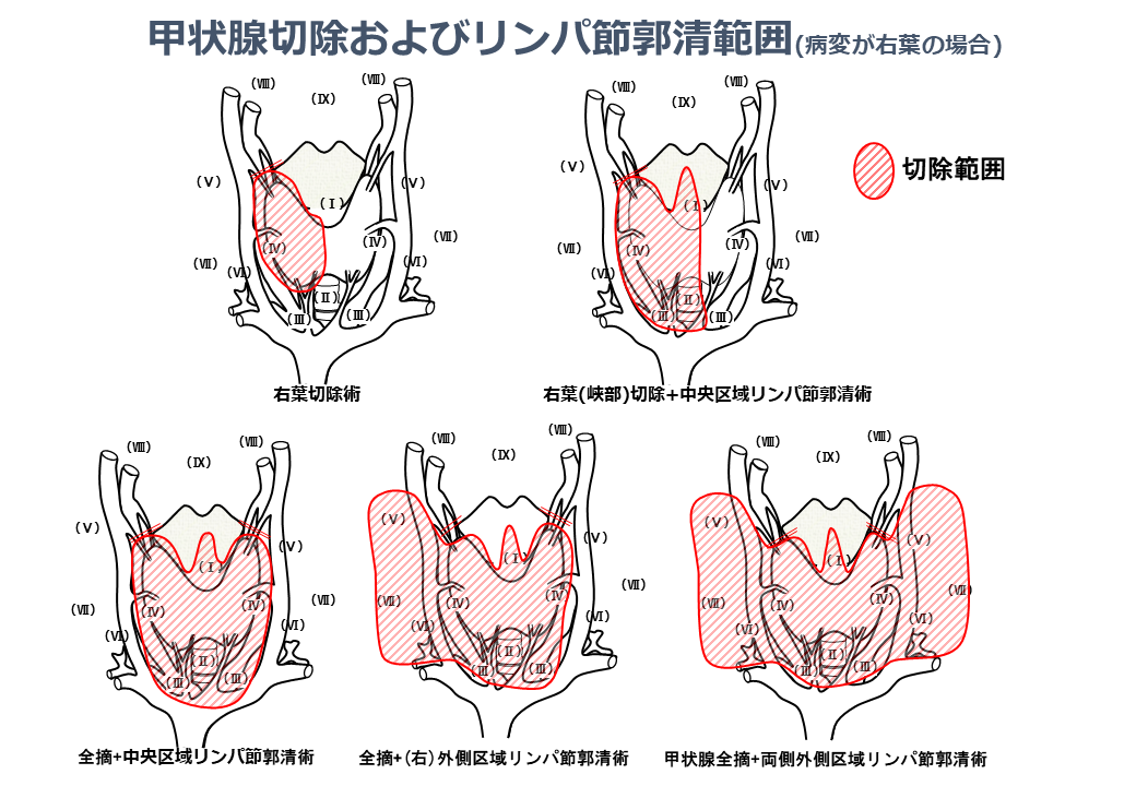 アフターケアと回復時間